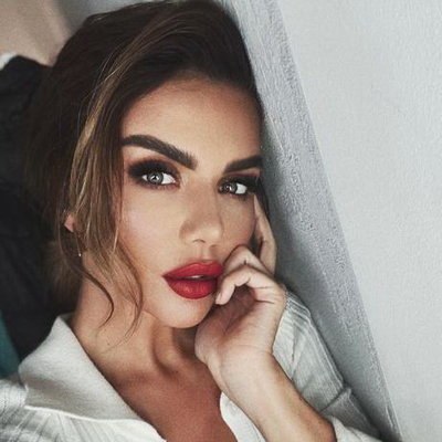 Анна Седокова лишилась ногтя, разнимая дерущихся собак