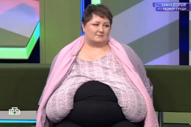 «Либо позвоночник треснет, либо я задохнусь»: женщина с 17 размером груди умирает из-за лишнего веса «Либо позвоночник треснет, либо я задохнусь»: женщина с 17 размером груди умирает из-за лишнего веса