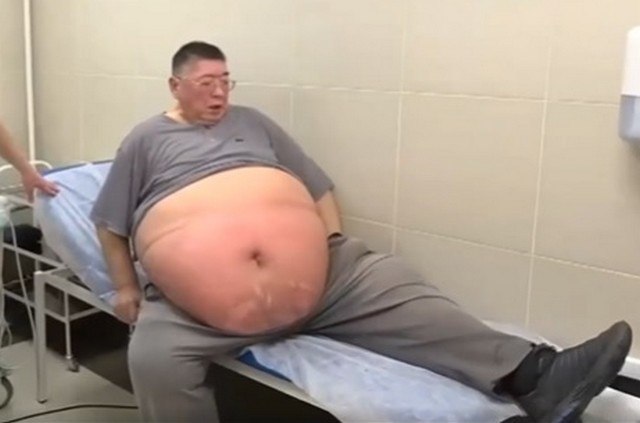 &laquo;Поскорее умереть и не мучиться&raquo;: мужчина располнел до 220 килограммов и не может сделать операцию