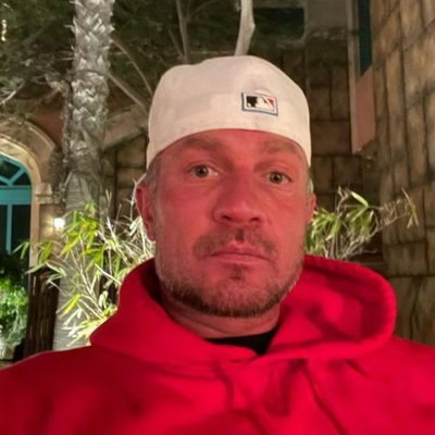 Роману Костомарову ампутировали кисти рук