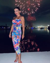 &laquo;Научусь с этим жить, не ненавидя свое тело&raquo;: Седокова показала следы от тяжелой болезни