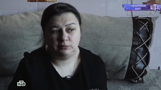 &laquo;Боюсь из-за нее умереть во сне&raquo;: от женщины с 15-м размером груди отказались пластические хирурги