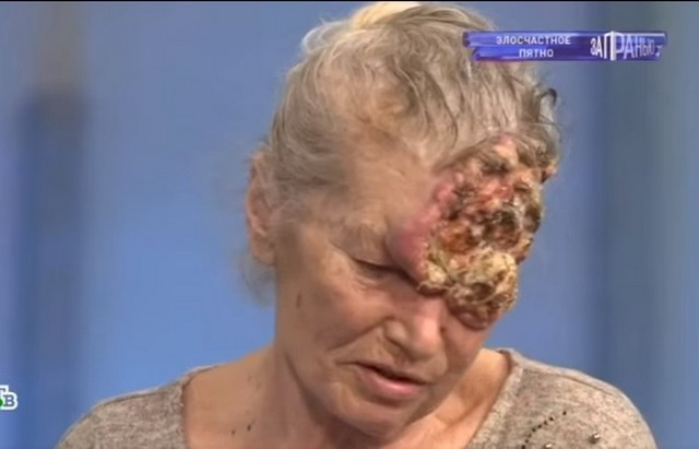 В студии НТВ Галина стесняется своего лица