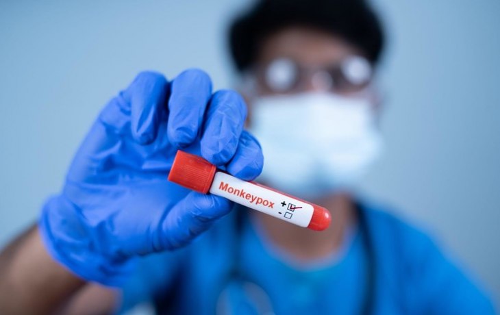 Гнойные волдыри и рубцы по всему телу. Как обезьянья оспа уродует внешность больных